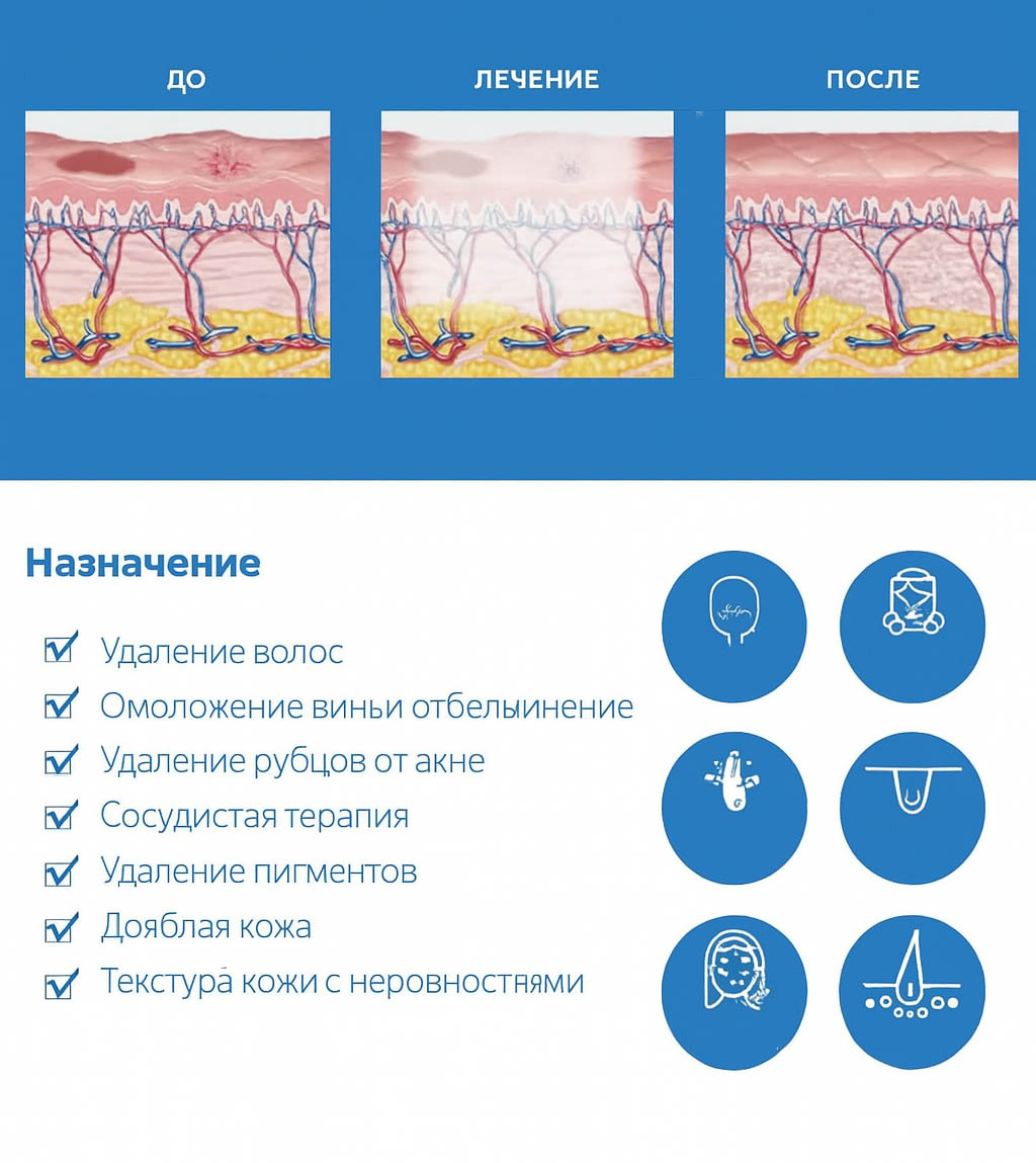 Схема воздействия Baby Light технологии